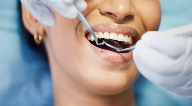 Best Emergency Dentist for Knocked-Out Tooth in Vero Lake Estates, FL